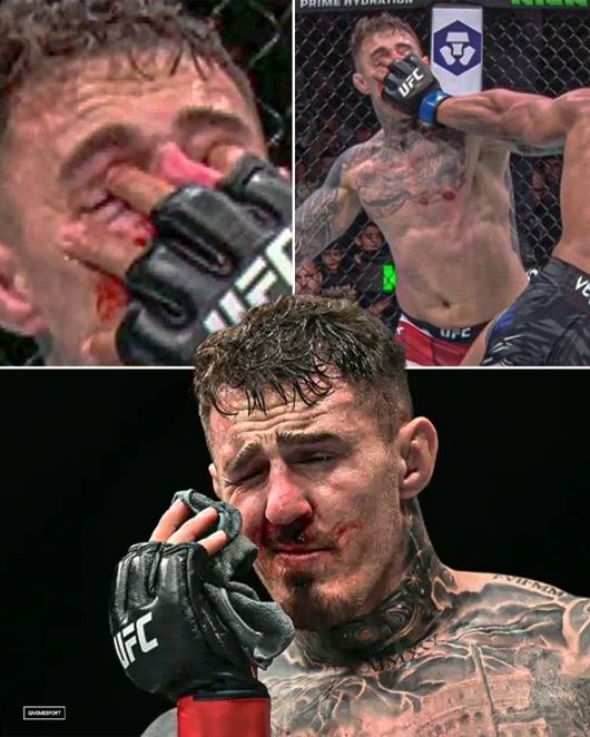 découvrez les séquelles oculaires subies par aspinall suite à l'incident avec gane, ainsi que les implications et traitements possibles.